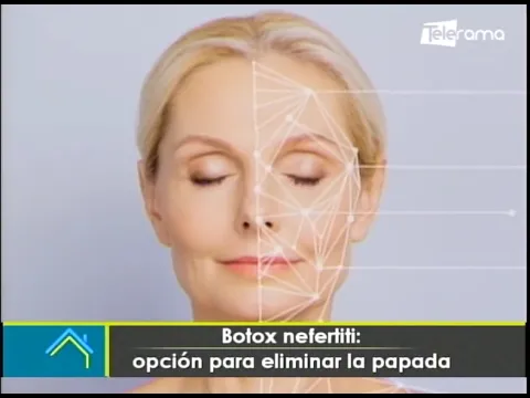 Estética al Día: Botox Nefertiti opción para eliminar la papada