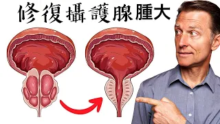 前列腺(攝護腺)腫大,最佳唯一食物,自然療法,柏格醫生 Dr Berg
