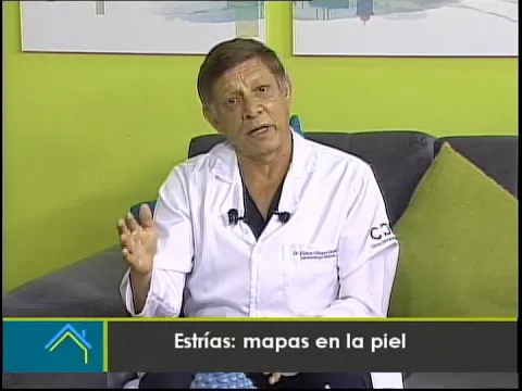 Estrías: Mapas en la piel