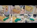 Laparoscopy colectomy CPT code - simplify medical coding