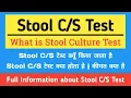Stool Culture Test Explained Stool Test Symptoms for Stool Culture Test