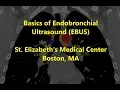 EBUS Basics and Mediastinal Staging -