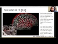 Introduction to functional MRI connectivity
