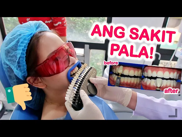 Vlogger Hazel Quing Teeth Whitening Experience