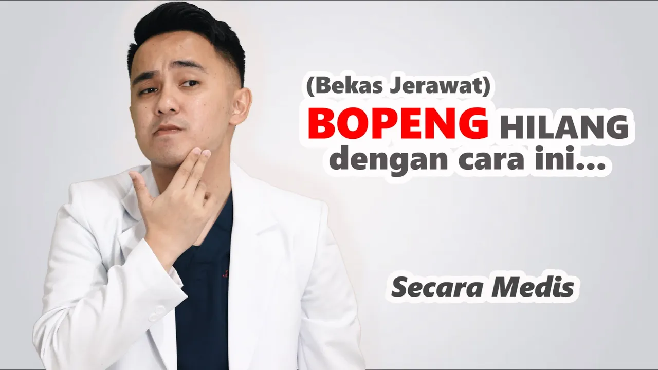 CARA MENGHILANGKAN BEKAS JERAWAT BOPENG | dr. Vania Utami. 