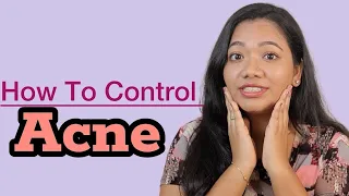 !! How To Treat Acne & Acne Marks 😱!!
