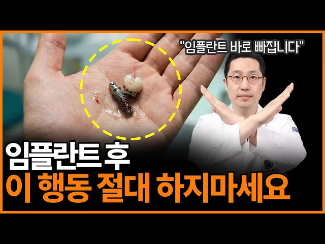 임플란트 후 ‘이것’ 절대 하지 마세요! 수백만 원 날리고 재수술합니다…ㅣ임플란트 주의사항