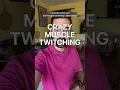 Muscles that won t stop twitching Benign fasciculation syndrome