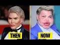 10 Celebrity Plastic Surgery Disasters You d Never Recognize Today Then and Now 2026