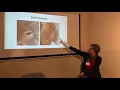 Wound Care Presentation 2018