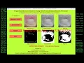 Python Code On FingerNail Disease Detection Using CNN Full Python Source Code