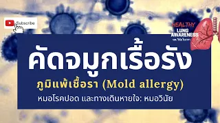 แพทย์จะตรวจหาการแพ้เชื้อราอย่างไร