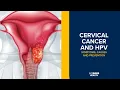 Cervical Cancer and HPV - Symptoms Causes and Prevention Explained UC Davis Health