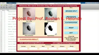 Melanoma Skin Cancer Detection Using CNN Convolutional Neural Network Project With Source Code