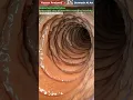 Download Lagu Intestines Slowed by Sitting Long Hours Animation | Gut Health | Human Anatomy | Stomach AI Art | 08