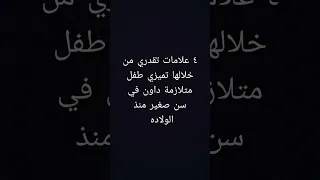 ٤ علامات تدل علي اصابة الطفل بمتلازمة داون 