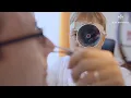 Nasal cautery with SILVERIN Silver Nitrate Sticks for recurrent