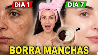 BORRA MANCHAS Y ARRUGAS EN 1 NOCHE! 😱 (Mi Secreto de Arroz y Café) ✨