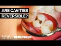 Dentists Debunk 15 More Teeth Myths Debunked