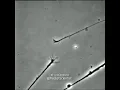 Download Lagu FINDING THAT CONNECTION© - neurons connecting to one another in a Petri dish - growth cones
