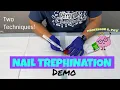Nail Trephination on Homemade Demo