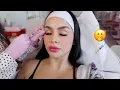 Getting BOTOX for the FIRST TIME