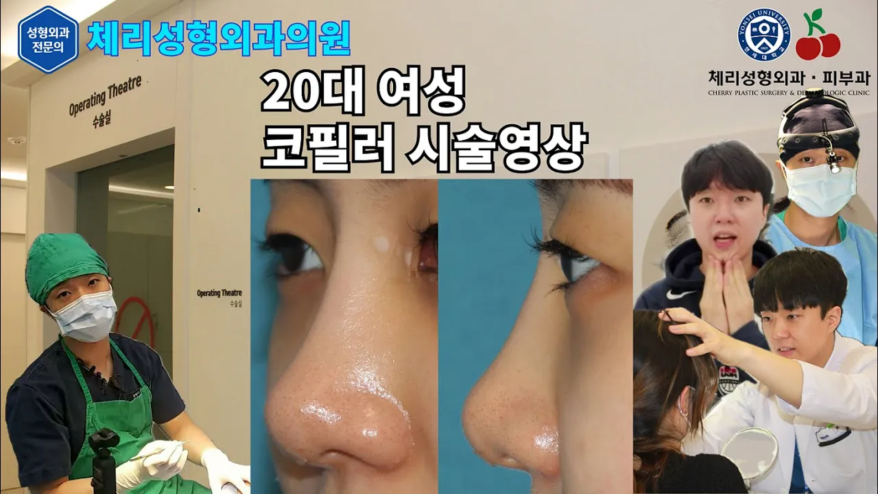 [체리성형외과의원] 코필러 시술 영상 / Nasal filler / Nose filler