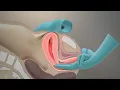 Download Lagu The Pelvic Examination | TVASurg