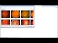 Optic Disc Localization Retinal Image Processing - MATLAB Code Implementation