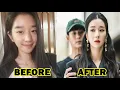 Seo ye-ji Before and after