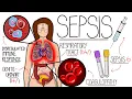 Understanding Sepsis Sepsis Explained Clearly