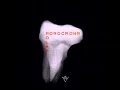 Lagu MONOCROWN - MOLAR