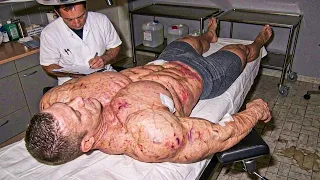 15 FISICOCULTURISTAS Que Fueron Demasiado Lejos Con Los Músculos