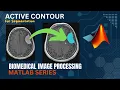 Snakes for quick Image segmentation Active contour tutorial