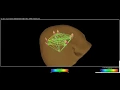 NeuroNavigator Functional Connectivity Labels inside of NeuroGuide