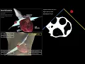 Download Lagu APIL Cardiac Ultrasound Simulator