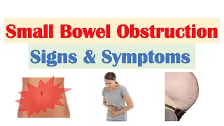 Small Bowel Obstruction SBO Signs Symptoms Why They Occur