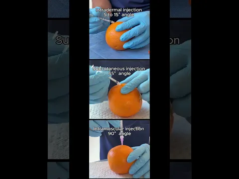 Injection angles made easy: IM vs SubQ vs Intradermal #nursing #nurse #injection #subcutaneous