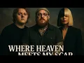 Download Lagu Lewis Capaldi ft. Teddy Swims \u0026 Sia – Where Heaven Meets My Scars – The Song That Heals Your Heart