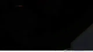 رودى بعد 20يوم 