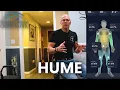 My Recommendation For The Hume Health Scale And All It Can Tell You About You