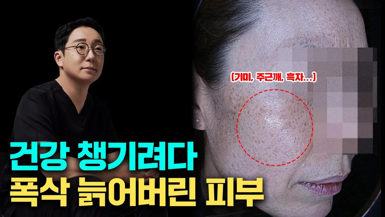 기미, 주근깨, 흑자, 잡티... 급격하게 늙어 버린 피부 다시 돌릴 수 있을까? / 오가나의 피부교정(색소침착)