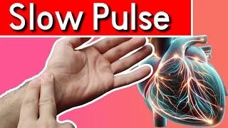 Why is My Pulse So Slow Top Causes of a Slow Pulse and When to Worry