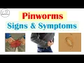 Pinworm Infections Signs Symptoms Why They Occur