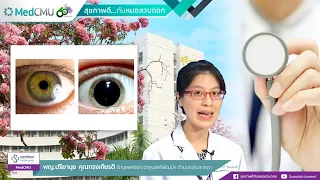 การขยายม่านตา คืออะไร และมีประโยชน์อย่างไรต่อการตรวจโรคตา
