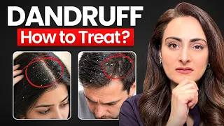 Dandruff | causes & treatment | best antidandruff shampoos