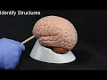 Quiz on Brain Structures