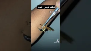 شاهد قرص النحله للانسان Shorts Short Foryou Bug Wasp Insects Animals Seting Venom Fyp Fy 