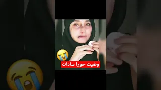 وضعیت حورا سادات چی شده  دندنها