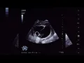 ElgrandeToto Ft Vacra - Totopika (Official Music Audio)